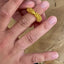 Acupressure massage ring for fingers